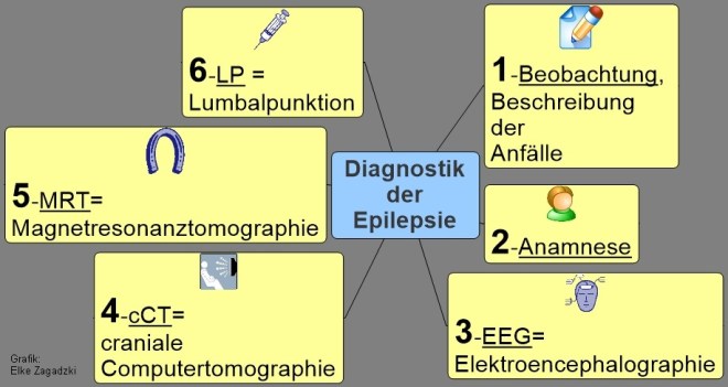 Diagnostik der Epilepsie