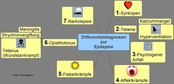 Differentialdiagnosen zur Epilepsie