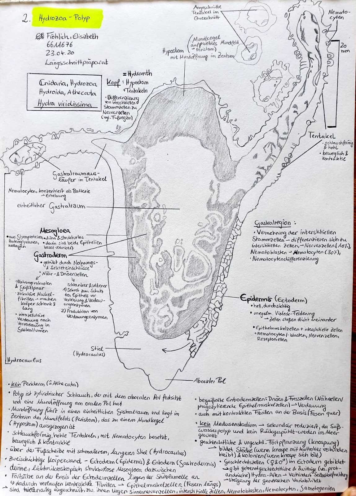 200525PolypElisabeth
